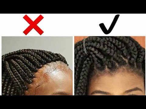 alopecia hair loss treatment